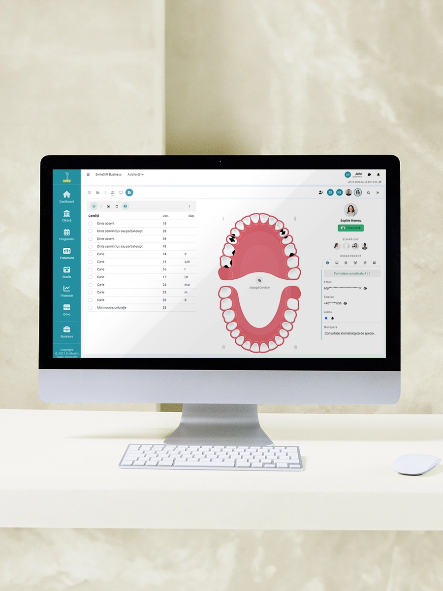 Grafic Dentar caracteristica aplicației software